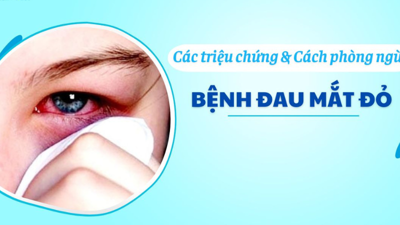 triệu chứng bệnh đau mắt đỏ