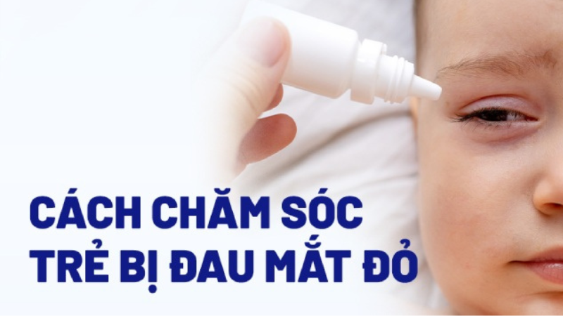 biểu hiện của bệnh đau mắt đỏ