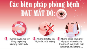 biểu hiện của bệnh đau mắt đỏ