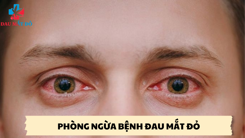 phòng ngừa bệnh đau mắt đỏ