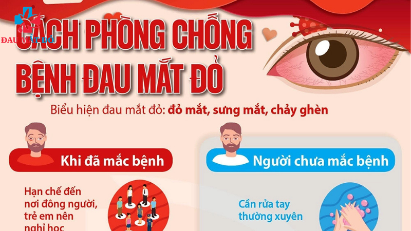 phòng ngừa bệnh đau mắt đỏ