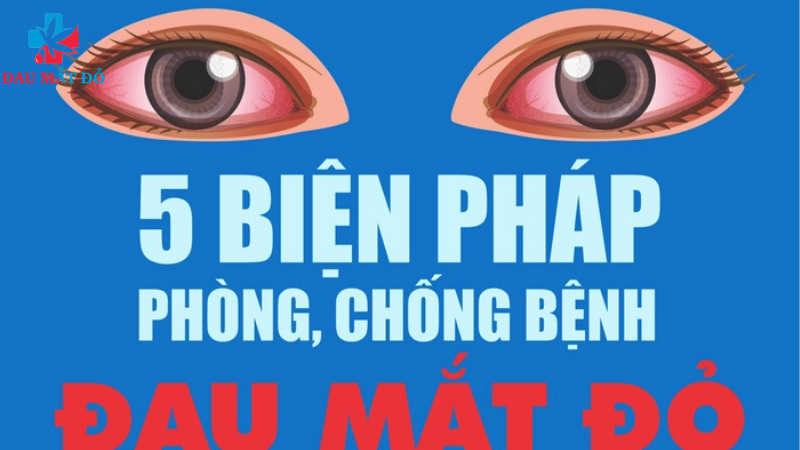 phòng ngừa bệnh đau mắt đỏ