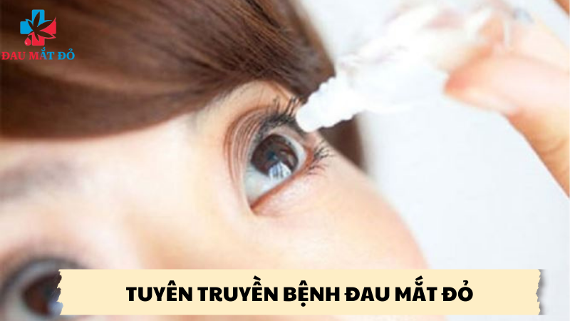 tuyên truyền bệnh đau mắt đỏ