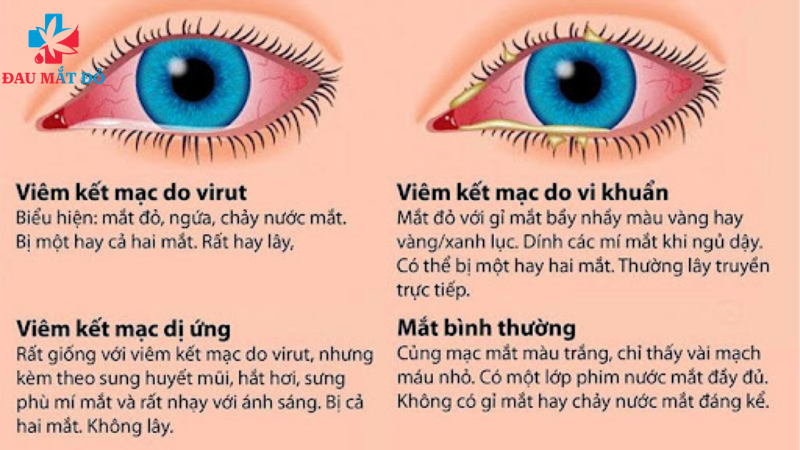 tuyên truyền bệnh đau mắt đỏ